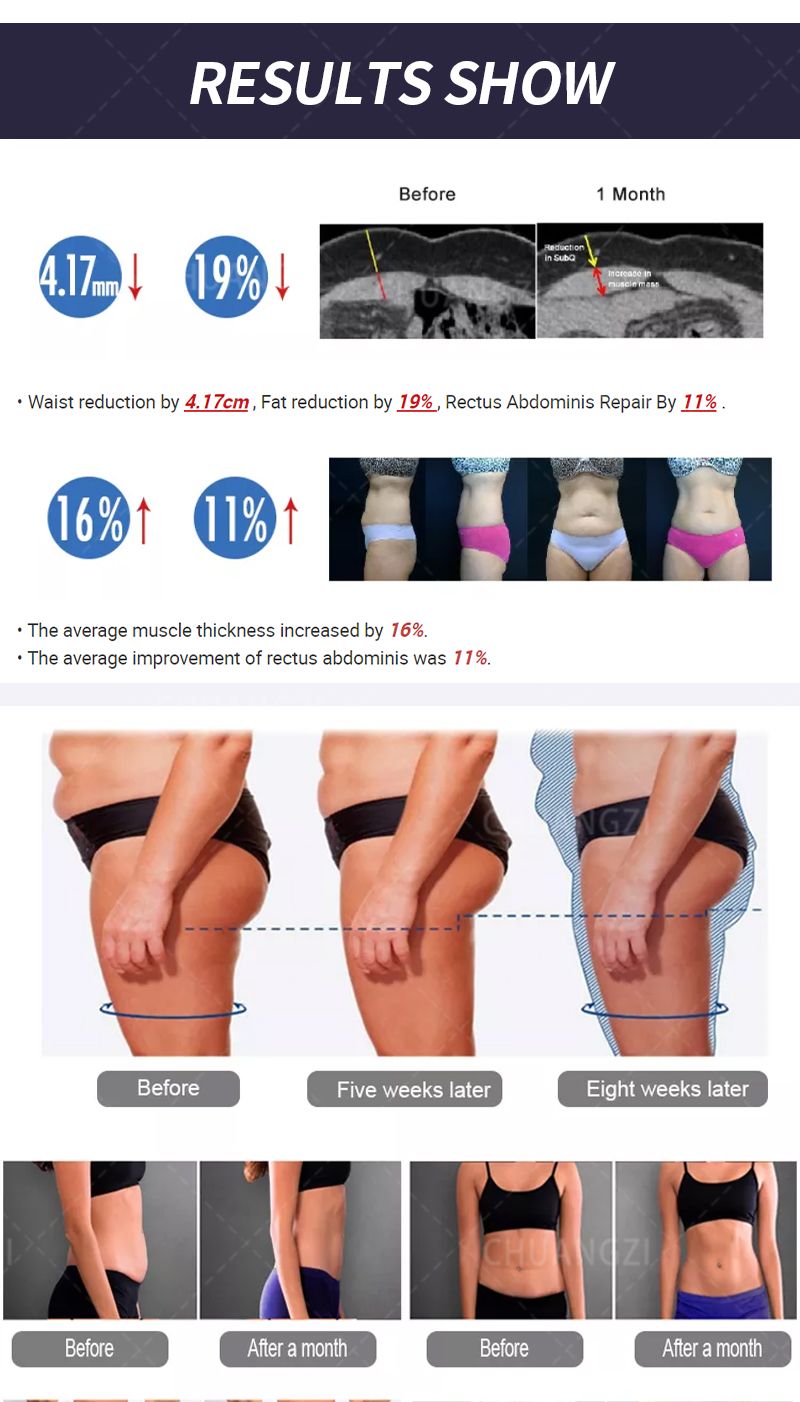 Professional RF MYOslim Body Sculpting Machine Electric Fat Burning Slimming Muscle Stimulator 15 Tes 6500W 5 Handle Neo