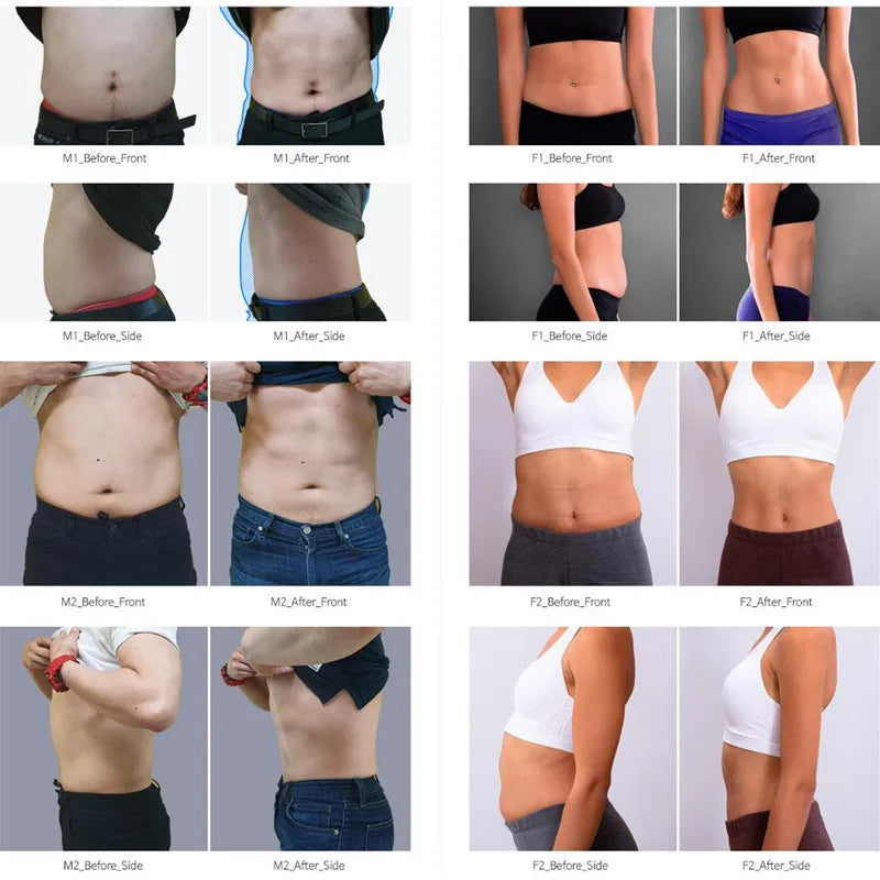 Professional EMSZERO Sculpting NEO RF Machine EMS Body Slimming HI-EMT PRO Muscle Stimulation Fat Removal