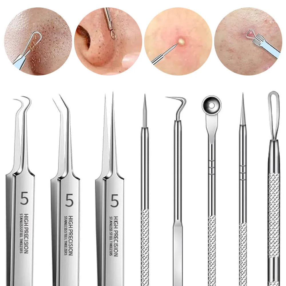 8pcs Professional Skin Care Tools Stainless Steel Pimple Extractors & Needles - for Blackhead Removal, Acne Treatment