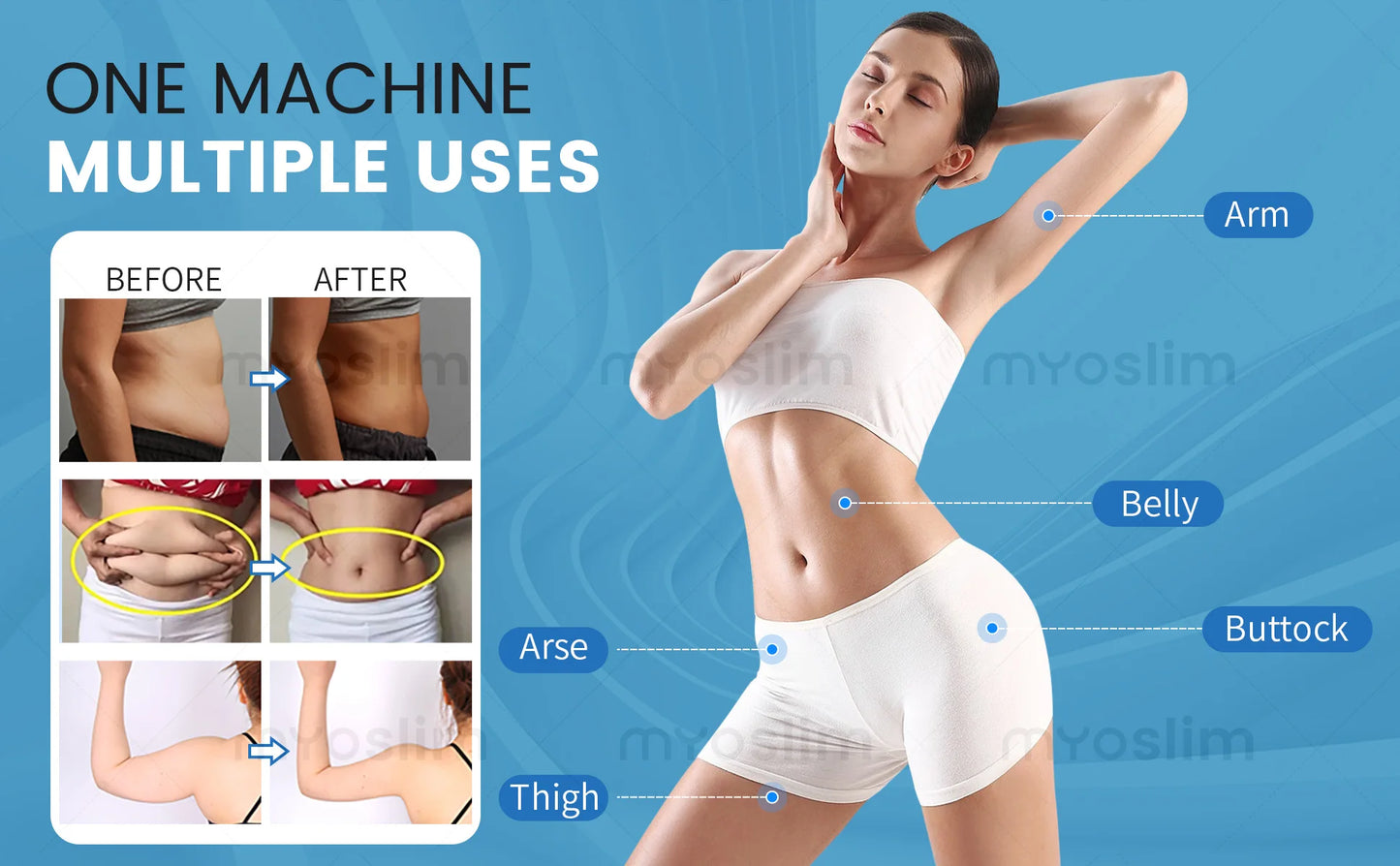 Professional EMS RF Body Sculpting Machine 15 Tesla 6500W Muscle Building Fat Burning Slimming Equipment