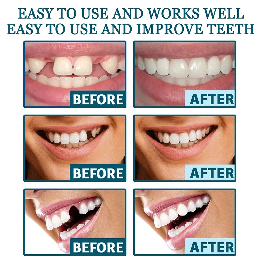 Adjustable Dentures Teeth Veneers Restoration Dentures Decorate  Imitation Tooth Cover Clip in Veneers Teeth for Men Women