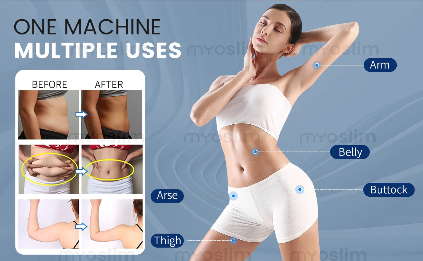 MYOslim 6500W 15Tesla 200HZ Electromagnetic EMS Body Sculpting Machine Muscle Toning Abdomen Buttocks Thighs Salon Home Use
