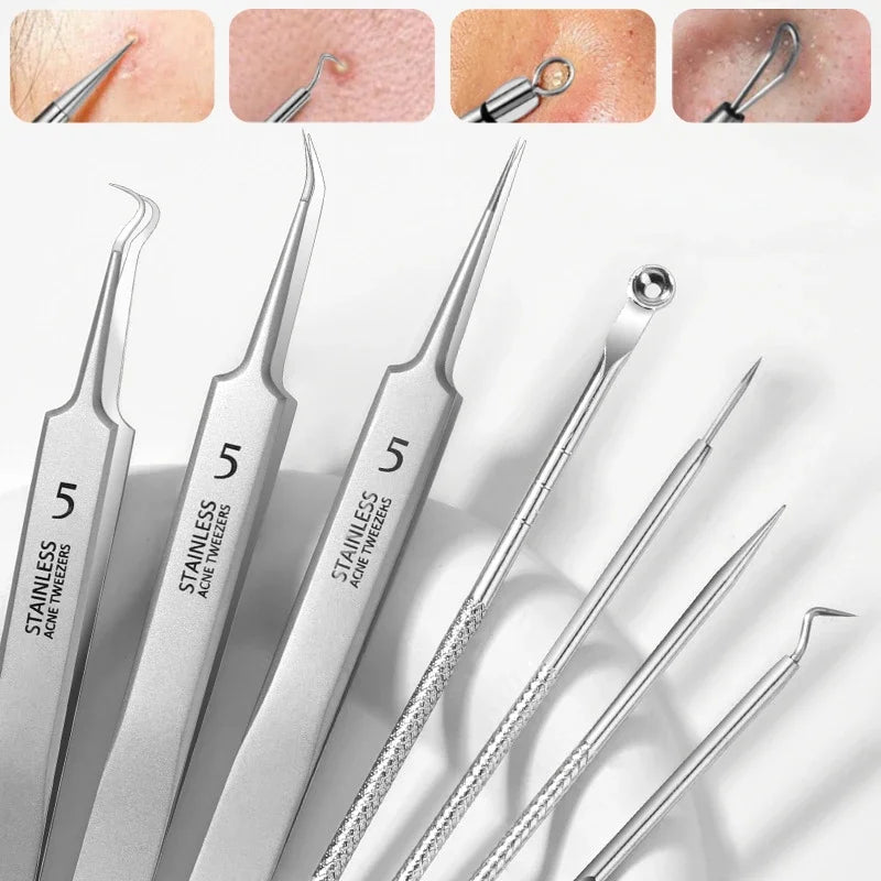 8pcs Professional Skin Care Tools Stainless Steel Pimple Extractors & Needles - for Blackhead Removal, Acne Treatment