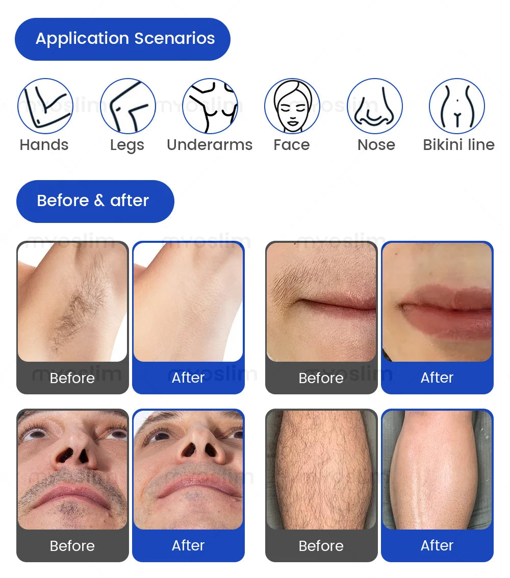 FAC 5000W 16Bars Diode Laser Hair Removal & Pico Laser Tattoo Removal 2-in-1 Machine 755 808 940 1064nm